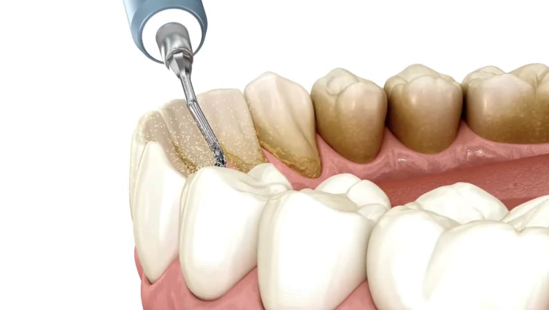 Dentysta: Poznaj pełen zakres pracy, specjalizacje i wpływ na zdrowie