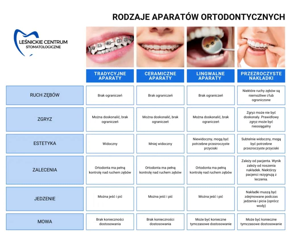 Aparat ortodontyczny: Rodzaje, ceny jak wybrać idealny?