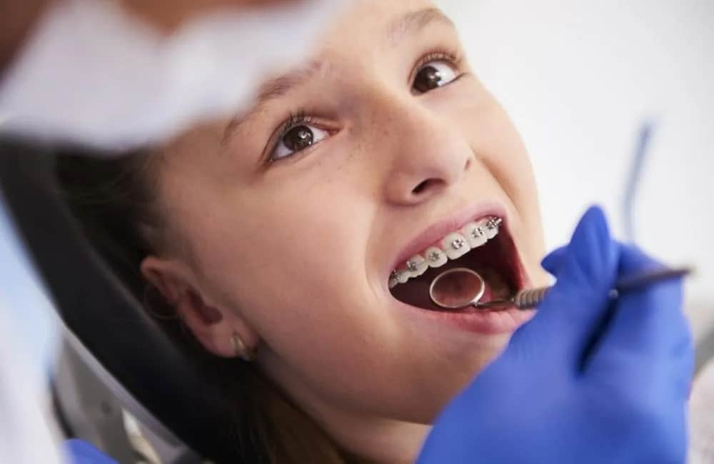 Ortodonta czy dentysta? Kto założy aparat na zęby?