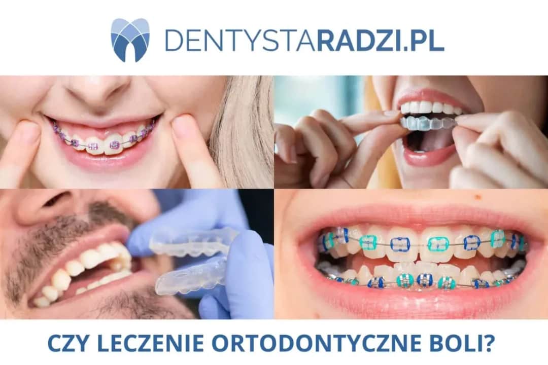 Czy aparat na zęby boli? Ekspert rozwiewa mity i radzi