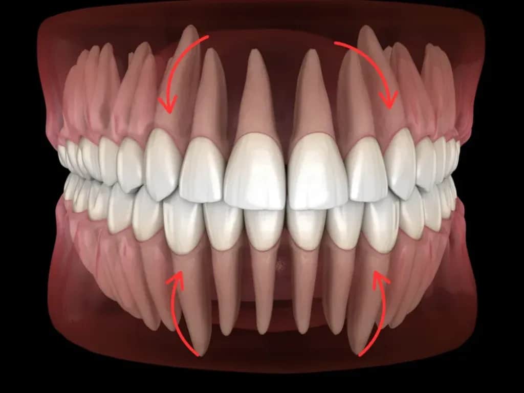 Zęby oczne: Które to kły i jak radzić sobie z ich bólem?