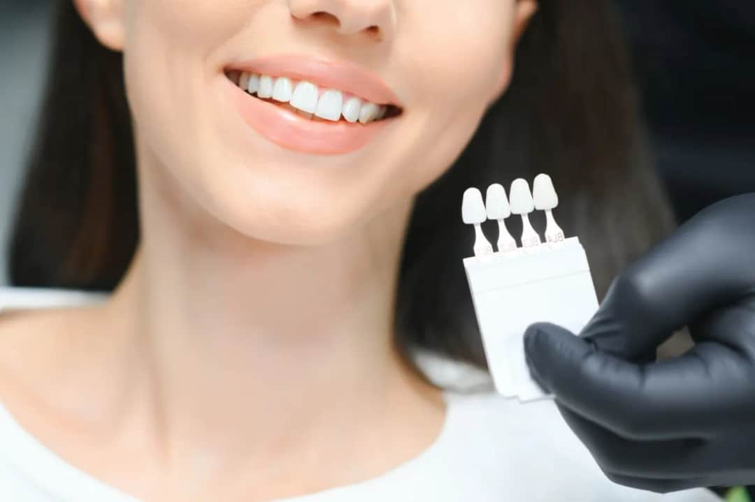 Wybielanie zębów: Ceny, metody, porady. Nie przepłacaj!