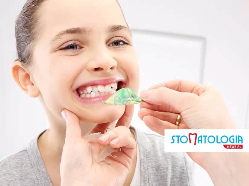 Aparat ruchomy dla dziecka: jak wygląda i prostuje zęby?