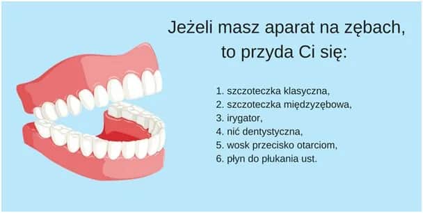Aparat na zęby: Kiedy jest konieczny? Rozpoznaj objawy!