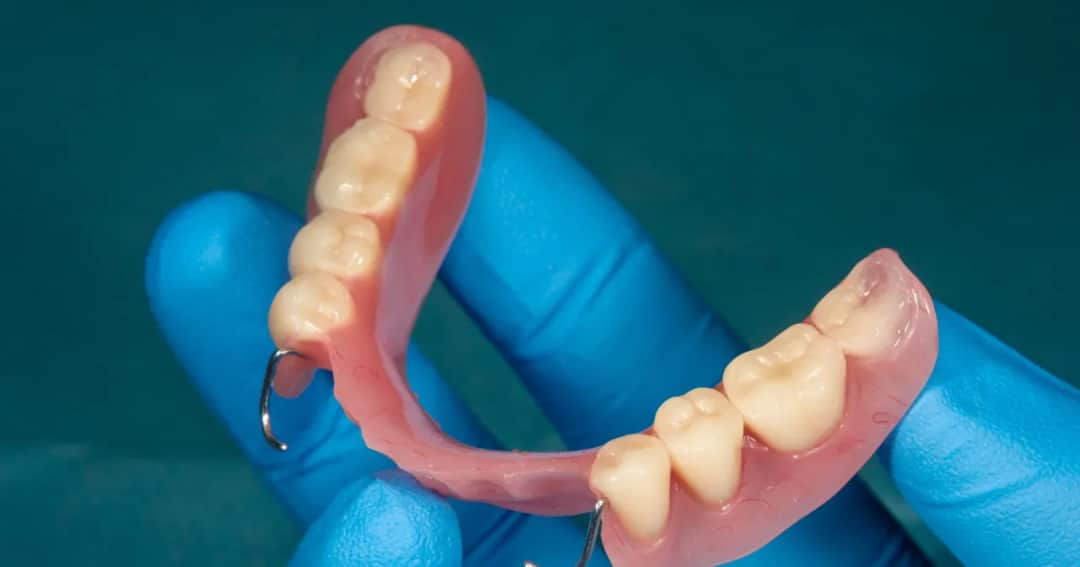 Aparat na zęby z NFZ: Kto i do kiedy ma szansę na refundację?